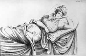 Schwarz-weiß Lithografie einer liegenden Frau mit einer Kaiserschnitt-Narbe