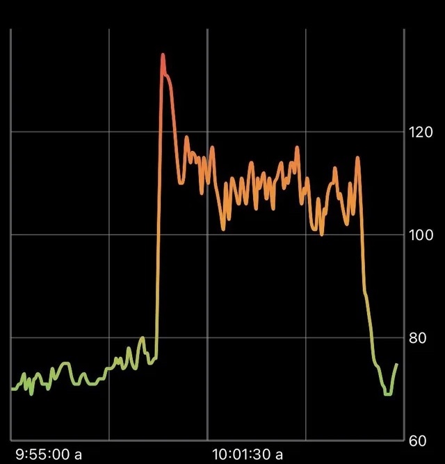 Diagramm mit einer aufgezeichneten hohen Herzfrequenz